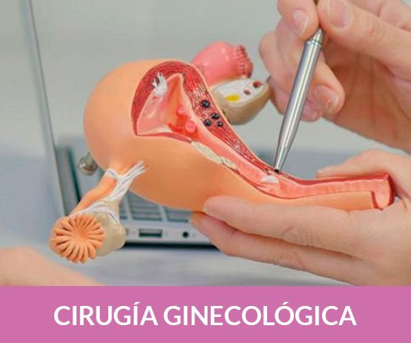 ginecólogas en puebla