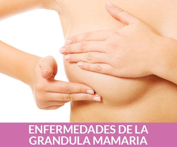 ginecólogas en puebla