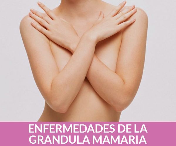 ginecólogas en puebla